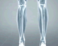 Maddy - Mocassins orthopédiques en cuir femme - DealValley