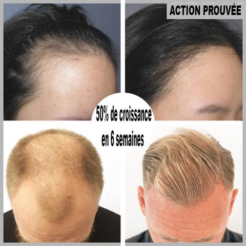 Roll-on spécial pousse des cheveux / 1 ACHETÉ = 1 OFFERT